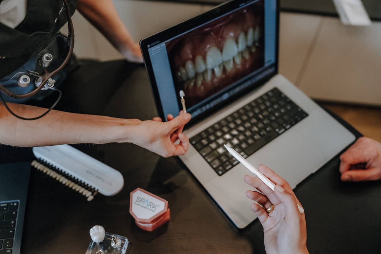 Zwei Behandler vergleichen ein Veneer-Muster mit der intraoralen Aufnahme am Laptop